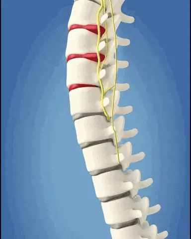 Cinturón Alivio Lumbar Térmico